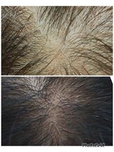 デピラード(Depilado)/