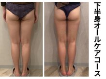 プラマイル(Pramile)/下半身オールケアコース