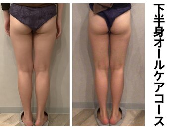 プラマイル(Pramile)/下半身オールケアコース