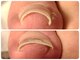 フットケアサロン ラビフット(Rabbi foot)の写真/【巻き爪矯正◇フットケア専門店】最適な施術をご提案し、快適な足元へ導きます！
