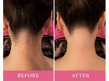 マロズワックス ブラジリアンワックスアンドスパ(Maro's Wax Brazilianwax Spa)/うなじWax★Before After