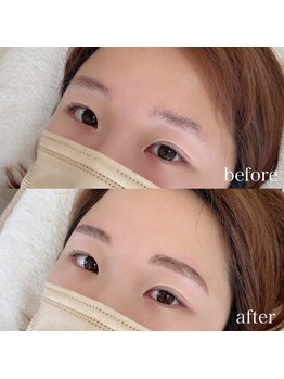 ダリ(Dali)/ハリウッドブロウリフト