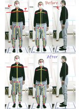 姫路なごみ整体院 なごみ鍼灸院/改善例（姿勢の悪や慢性腰痛）