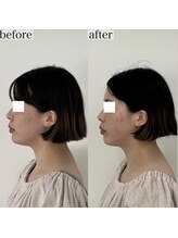 ヴェルシック(Belchic)/美しい横顔が叶うサロン