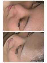 リボーン(be reborn)/毛穴が目立たなくなりました☆