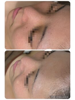 リボーン(be reborn)/毛穴が目立たなくなりました☆