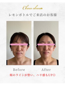 シュシュ(Chouchou)/レッドショット1回