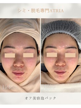 アトリア(ATRIA)/ピュールボーテ化粧品 オフ美容