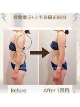 カモン(KAMON)/【姿勢矯正】骨盤+上半身矯正