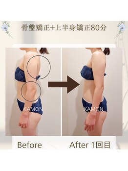 カモン(KAMON)/【姿勢矯正】骨盤+上半身矯正