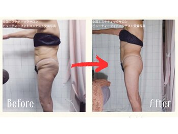 エンダモロジーサロン ココロミ(Cocolomi)/エンダモロジー結果写真１
