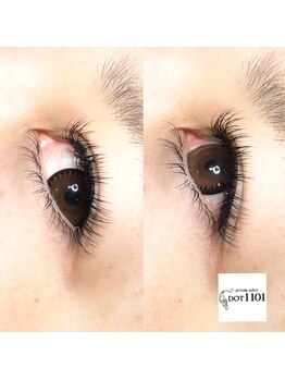 ドットイチイチマルイチ 銀座店(DOT1101)/ミンク上下付け放題