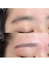 ドリー(DOLLY)/ワックス脱毛