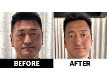 ありがとうパパの腸もみサロン アンド スクール/ビフォーアフター