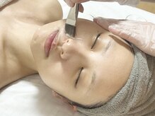 ピョル(pyoru)/ララピール施術工程