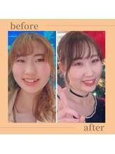 ヨサパーク 温美(YOSA PARK) Owner Eriko