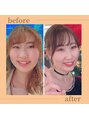 ヨサパーク 温美(YOSA PARK) Owner Eriko