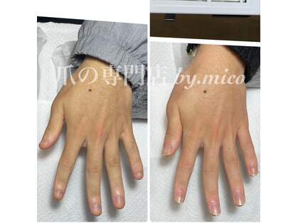 ミコ(.mico)の写真