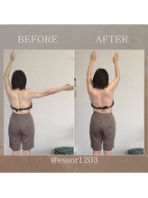 エソール(essor)/上がらなかった肩が上がるように