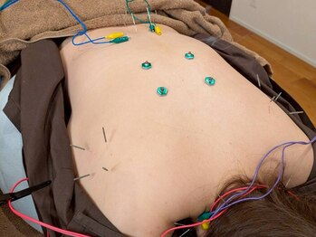 キュー 高槻(cue.)/からだの鍼 60分 ¥6,500