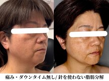 サンポ 神戸元町店(SANPO)