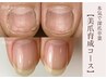 【本気で深爪を卒業】 深爪育成トライアルコース