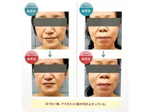 エルムの雰囲気（インナーマッスルトリートメント×手技で一目瞭然のリフトアップ）