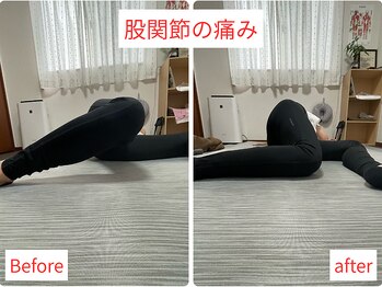 活法術 福岡整体院/股関節の不調に！