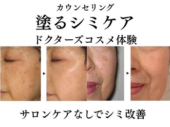 テセラ(Tethere)の写真/【塗るシミケア】サロンに通えない忙しい方におすすめ！塗るだけでシミが改善。