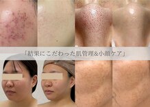 リル ビューティー ラボ(LILU BEAUTY LAB)