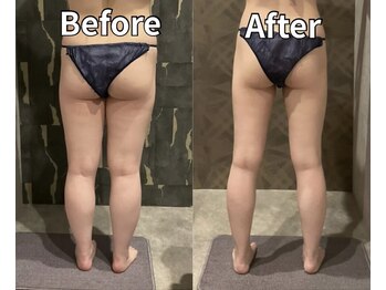 オーパス ビューティー(OPUS Beauty)の写真/パンツを太ももに合わせて選ぶ毎日から卒業!!気になる太もも・ヒップを集中ケアし美脚へ。