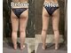 オーパス ビューティー(OPUS Beauty)の写真/パンツを太ももに合わせて選ぶ毎日から卒業!!気になる太もも・ヒップを集中ケアし美脚へ。
