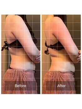 マリー(Mary.)/二の腕