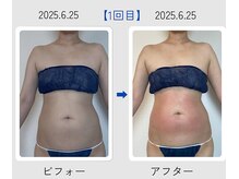 ネオボディ(Neo Body)/ポッコリお腹から卒業したい