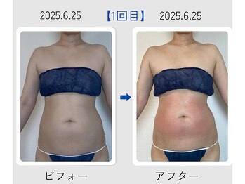 ネオボディ(Neo Body)/ポッコリお腹から卒業したい