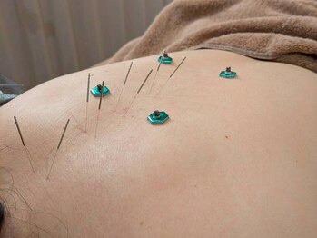 キュー 高槻(cue.)/からだの鍼 60分 ¥6,500