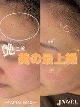 ジェノール 2nd beauty studio 姫路駅前店(JNOEL)/艶こそ美の最上級！素肌美女