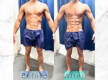 パラディ(PARADIS)/ハイパーナイフ