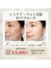 【再来店様限定！】シミケア×フォト美顔のWアプローチ 特別価格70分¥8,800