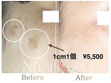 サロンドオール(Salon de Or.)の雰囲気（１回の施術で《変化がわかる！》顔も体のシミ、色素沈着もOK）