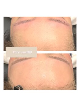 ヴィーナス アイビューティー(VENUS Eye Beauty)/フェイスワックスでたまご肌