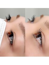 レジアント(Rediant)/パリジェンヌラッシュリフト