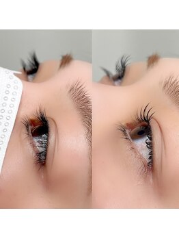 レジアント(Rediant)/パリジェンヌラッシュリフト