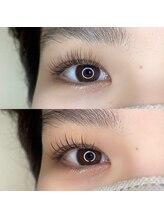 リンネ(LinNe)/KURUMI担当