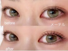 アノ チャーム(ano charm)/メーテル