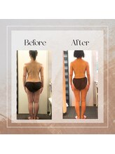 アーマンクラージュ(Ahmen Courage)/究極デトックスの活性化リンパ