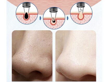ベラ(VERA)の写真