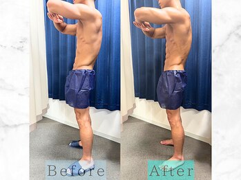 パラディ(PARADIS)/ハイパーナイフ