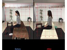 ストレチックス 近江八幡店/首・肩に痛みがあった女性