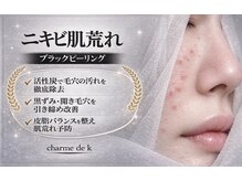 シャルム ド ケー(charme de k)の雰囲気(繰り返すニキビ肌荒れでお悩みの方、お任せください!)